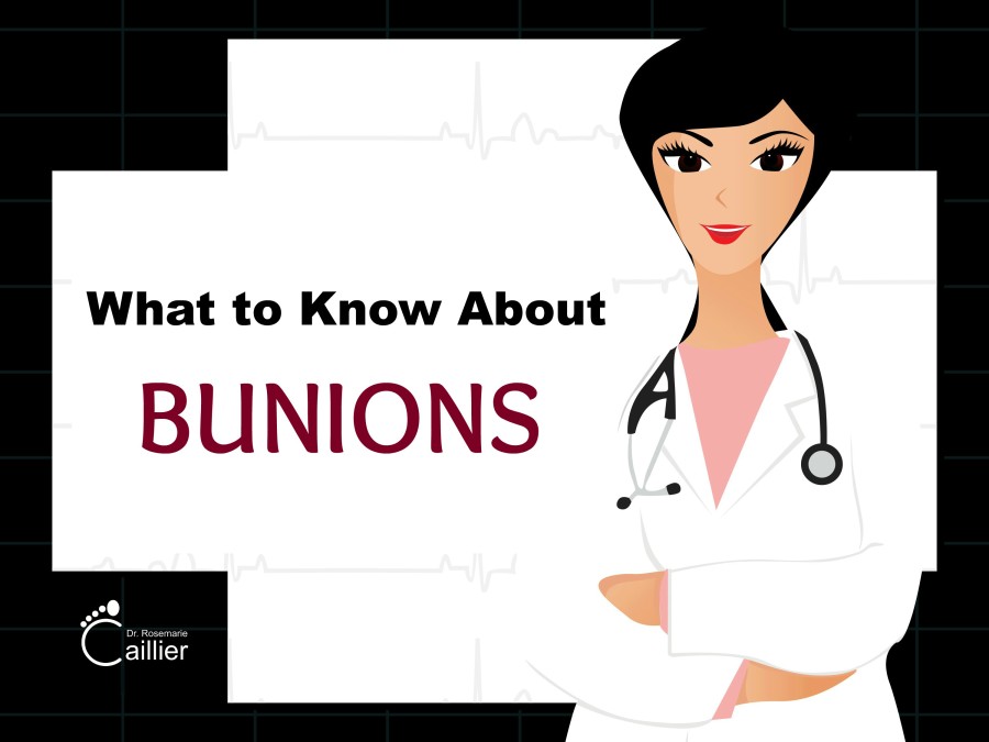 What to Know About Bunions