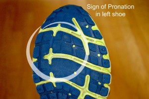 Sign of pronation in running shoe. -- Podiatry Care in Tuscaloosa, AL: Dr. Rosemarie Caillier